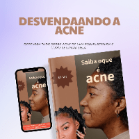 Imagem do produto Desvendando a Acne