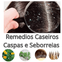 Imagem do produto (Hidratação Para Cabelo Receita Fortemente)
