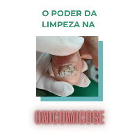 Imagem do produto A Poder Da Limpeza Na Onicomicose