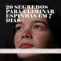 Imagem do curso 20 Segredos para Eliminar Espinhas em 7 Dias