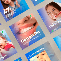 Imagem do produto Pacote posts Instagram - Odontologia