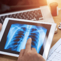 Imagem do produto E-BOOKS: FISIOTERAPIA RESPIRATÓRIA + GUIA DA VENTILAÇÃO MECÂNICA
