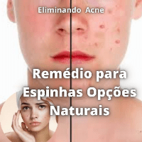 Imagem do curso ( Remédio Caseirinho para Espinhas Opções Naturais )