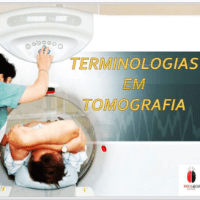 Imagem do produto TERMINOLOGIA NA TOMOGRAFIA COMPUTADORIZADA
