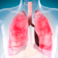 Imagem do produto CURSO DE FISIOLOGIA CARDIOPULMONAR 180H - GRÁTIS: CURSO DE VENTILAÇÃO MECÂNICA 180H [Certificação de formação continuada 360h]