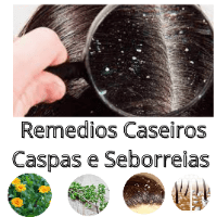 Imagem do produto Remédio Caseiros Para Caspas e Seborreias