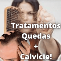 Imagem do produto ( Receitas Caseirinhas - Tratamento De Queda De Cabelos + Curas de Calvicie )