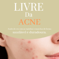 Imagem do produto Livre da Acne