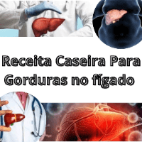 Imagem do produto RECITAS PARA DESINTOXICAR O FIGADO E ESTOMAGO
