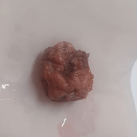 Imagem do produto ANÁLISE MACROSCÓPICA DE BIÓPSIAS