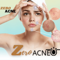 Imagem do produto ZERO ACNE