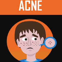 Imagem do produto Acne Zero
