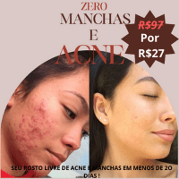 Imagem do produto Clara fotos