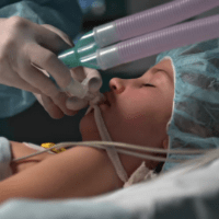 Imagem do produto Curso EAD - Ventilação Mecânica em UTI Neopediátrica - Certificado reconhecido 360 horas - BOLSA 50%