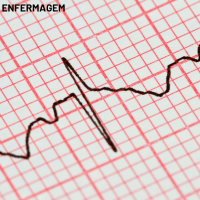Imagem do produto Eletrocardiograma para Enfermeiros