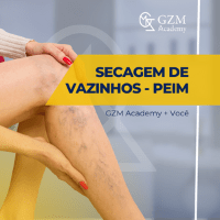 Imagem do produto Curso de Secagem de Vasinhos para Profissionais da Saúde Estética