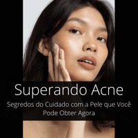 Imagem do produto Superando a Acne
