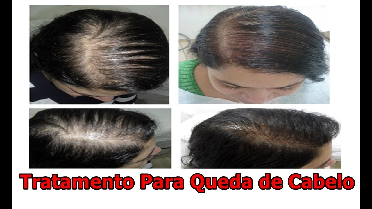 Imagem do curso 50 Produtos naturais para acabar com a queda de cabelo