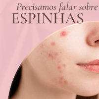 Imagem do produto Fique livre das espinhas