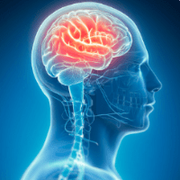 Imagem do produto Curso EAD - Fisioterapia Neurofuncional  - Certificado 360 horas Liberado pelo MEC