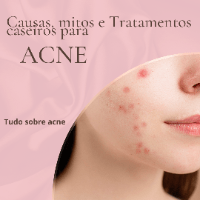 Imagem do produto Tudo Sobre Acne