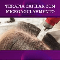Imagem do produto TERAPIA CAPILAR COM MICROAGULHAMENTO