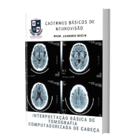 Imagem do produto Interpretação Básica de Tomografia Computadorizada de Cabeça