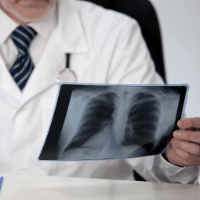 Imagem do produto Curso EAD - Imaginologia do Tórax - Certificado 180 horas Liberado pelo MEC