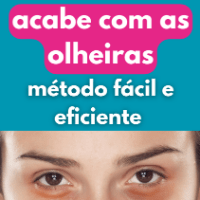 Imagem do produto Acabe com as olheiras, método fácil e eficiente