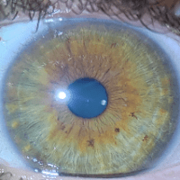 Imagem do produto Curso Intensivo de Iridologia