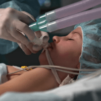 Imagem do curso Curso avançado de VENTILAÇÃO MECÂNICA EM NEOPEDIATRIA - Certificação de 220 horas - 100% ONLINE - Início Imediato