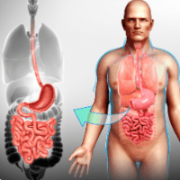 Imagem do produto Curso EAD - Anatomia Humana e Doenças Associadas - Certificado 360 horas Liberado pelo MEC.