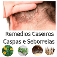Imagem do curso (Remédios Caseiros Para Caspas e Ceborreias)